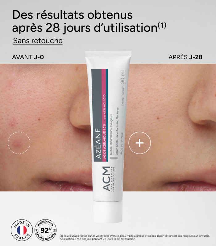 Azéane Cream 15% Azelaic Acid