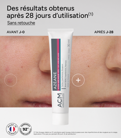Azéane Cream 15% Azelaic Acid